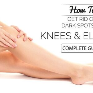What Causes Dark Knees and How to Lighten Them Naturally