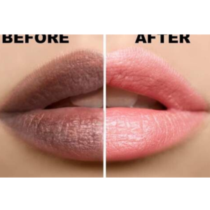 16 Ways to Lighten Dark Lips